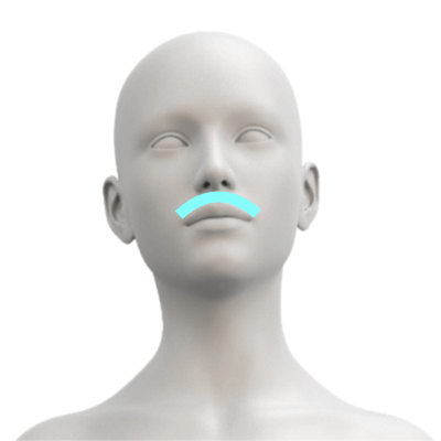 Laser Hair Removal for Women's Upper Lip